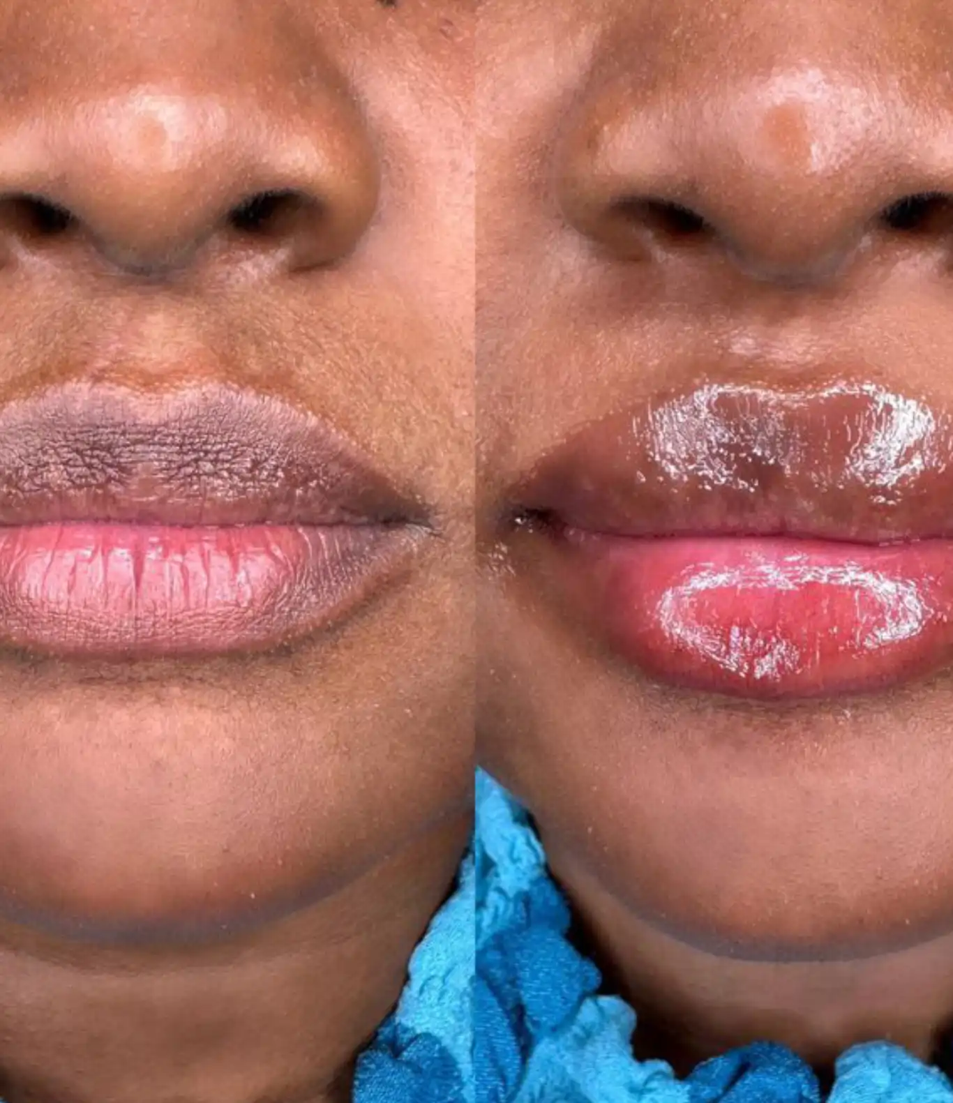lip-blush