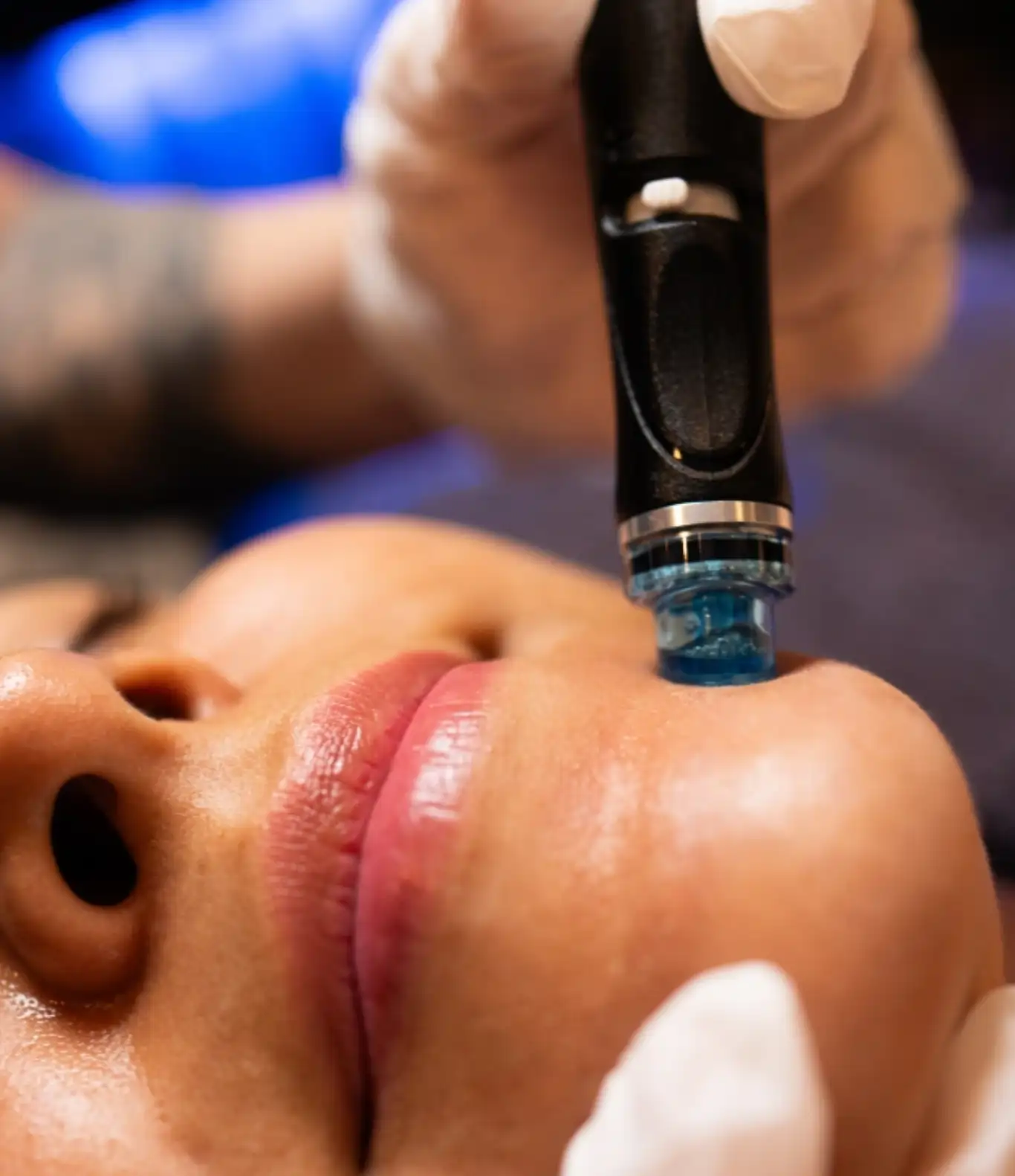 hydra-facial