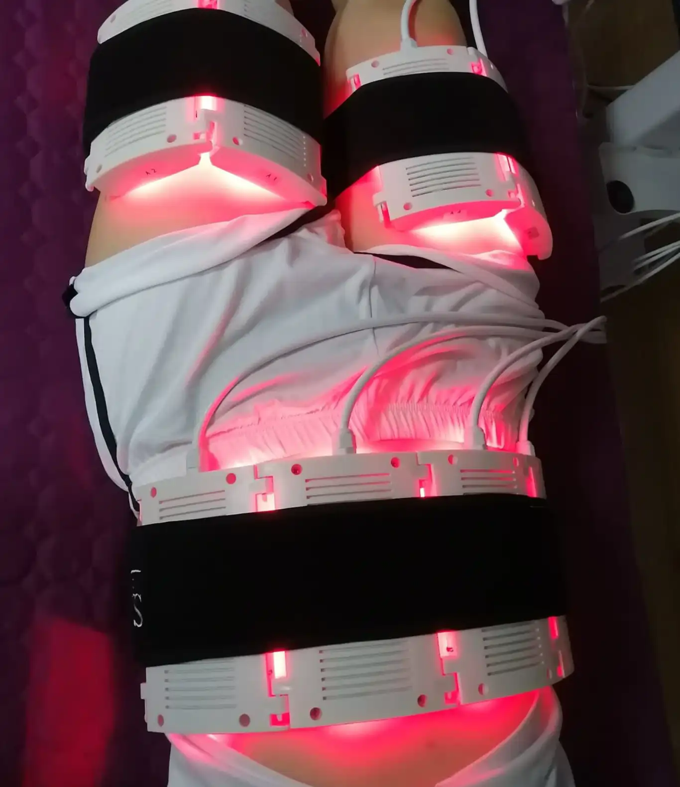laser-lipo